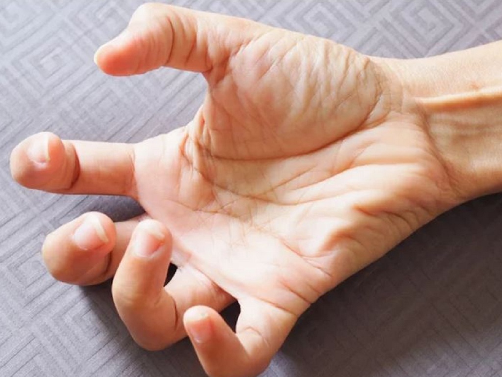 co giật là biến chứng của cúm mùa