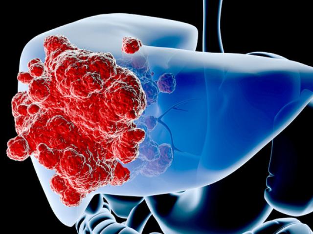 uống cô ca nhiều gây ung thư