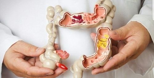 Dấu hiệu táo bón thường gặp như phân khô cứng, đi ngoài khó và phải rặn nhiều