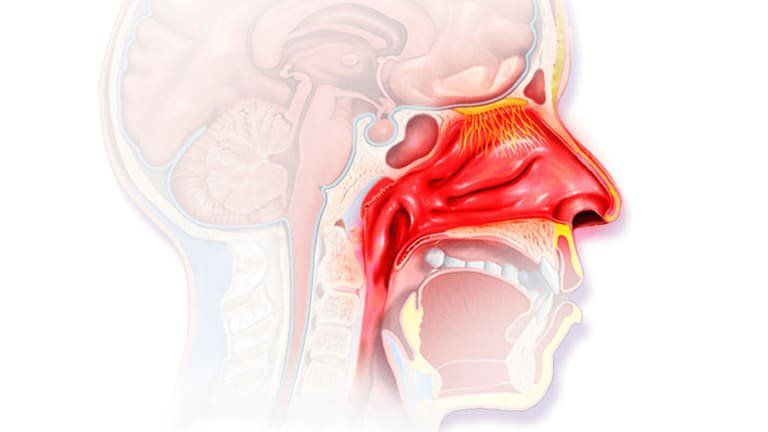 Niêm mạc đường thở cần thời gian hồi phục nên cơn ho có thể kéo dài nhiều tuần